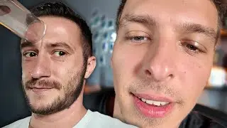 TOHLE VIDEO MÁ SOUHRNNÉ IQ 23 🤤