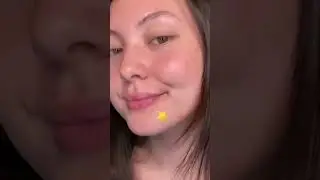 testing out the starface pimple patches!