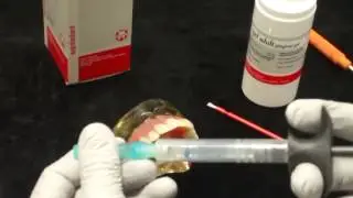 Xogel 국소마취전 도포마취