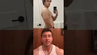 Ралоксифен для гинекомастии