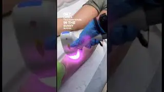 126. Kereshmah Laser Hair Removal
