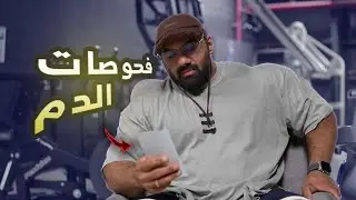 فحوصات الدم مع اللوبستر 🦞