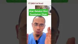 Alat Deteksi Dini Sumbatan Pembuluh Darah Otak. #short #stroke #deteksidini #doktersaraf #sumbatan