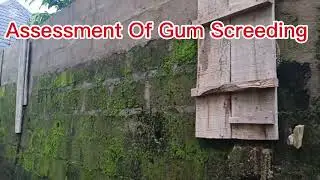 Live in Ebonyi state, Assessment of purely gum screeding and Graphtex paints 08064995148