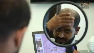 Hair Solutions Non Surgical Hair Replacement Procedure