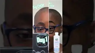 Unlock your hair's potential with Mary Ruth's Hair Growth Max! #HealthyHair#HairGrowth#NaturalBeauty