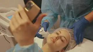 LA RADIOFR&Eacute;QUENCE POUR TRAITER LE D&Eacute;BUT DU REL&Acirc;CHEMENT CUTAN&Eacute; @ Guess Clinic
