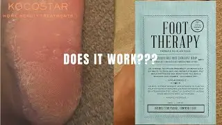 KOCOSTAR | Korean Foot Therapy | Does It Work?
