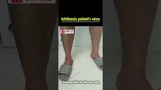 Ichthyosis patient's voice #ichthyosistreatment #ichthyosis #ichthyosisvulgaris #lamellarichthyosis