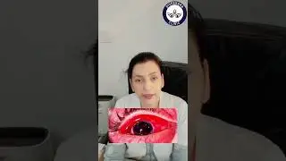 Blunt Trauma to the Eye &mdash; Know the Signs, Save Your Sight
