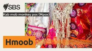 Kab mob monkey pox (Mpox) | SBS Hmong - SBS Hmong