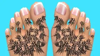 Foot Clinic - Gameplay Walkthrough - All Levels (IOS, Android)