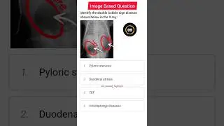 Image Based Questions| Image Based Mcqs| Nursing Superintendent Exam Preparation #rrb #ibq #ncert