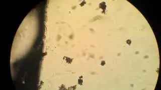 protozoon