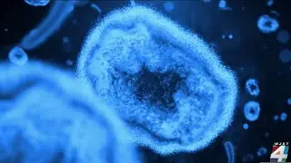 Jacksonville-area doctor frustrated over lack of monkeypox prevention