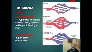 CIRCULATORY DISTURBANCES     CONGESTION AND ISCHAMIAppt