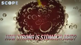 How Strong is Stomach Acid? | Angry Time with Jalan Moans