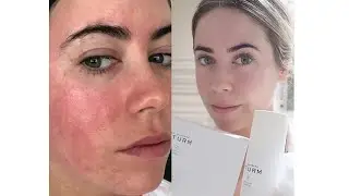 DR. BARBARA STURM SKINCARE REVIEW