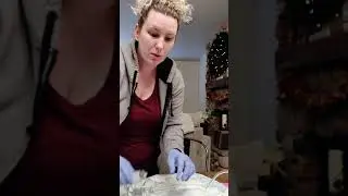 Watch me give myself an infusion at home! IVIG infusion day 2 - stiff person syndrome, sjogren's