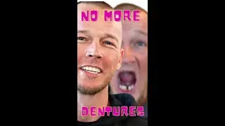 Young And In Dentures
