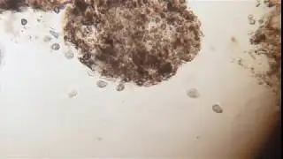 Moving Parasites (Chilodonella) on Discus Fish