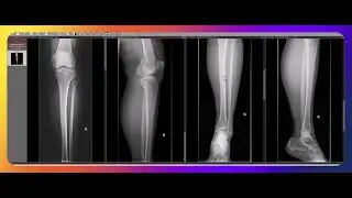 How to interpret a leg X-ray?