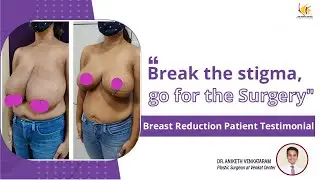 Breast Reduction Surgery Experience | Breast Size Reduction Treatment | Venkat Center