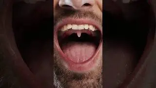 Qu&eacute; es eso al final de tu boca? 😮👀  #xpresstv #curiosidades