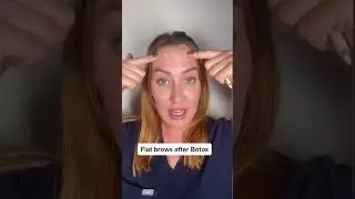 Avoid heavy brows after Botox #botox #botoxtips #botoxbrows