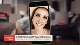 Selfie filters leading to snapchat dysmorphia
