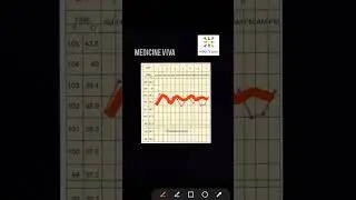 Medicine Continuous fever