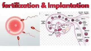#Fertilization & Implantation#SR Nursing lectures
