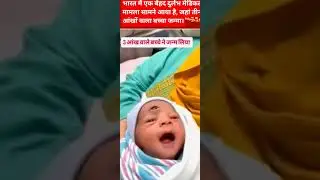 😱 तीन आंखों वाला बच्चा पैदा!भारत का rare medical case 🔴#BreakingNews #vairalnews #news #vairal
