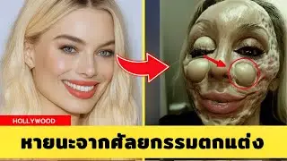 7 เหตุการณ์ศัลยกรรมคนดังที่ทำให้ฮอลลีวูดช็อก | Then & Now ปี 2025