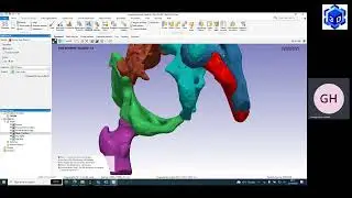 3D GRAPHY - 3D SEGMENTATION DEMO BY  SIMPLEWARE SYNOPSYS SCAN IP