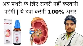 Best Homeopathic medicine for stone | SBL Clear Stone Drops | Dr Praveen Sharma