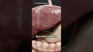 Remarkable Regeneration Of Liver