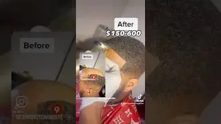 $150-$600 man weave hair restoration 😳