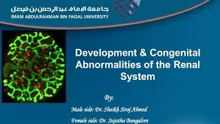 Anatomy - Development and Congenital Anomalies of the Renal System - MEDRECALL 