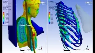 ANSYS WB Explicit Dynamics - FEA simulation of the biomechanics of a leg kick in the chest