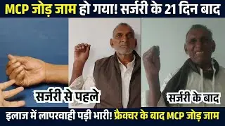 गलत इलाज ने हाथ जाम कर दिया! फ्रैक्चर के बाद MCP जोड़ लॉक — सर्जरी के 21 दिन बाद | MCP Jaamed