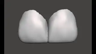 Fabricación de Provisionales para Carillas usando Meshmixer: Dr. Rafael A. Domínguez Cervera.