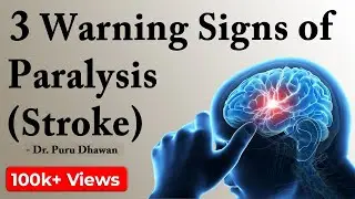 3 Warning Signs of Paralysis (Stroke)