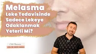 Melasma Leke Tedavisinde Sadece Lekeye Odaklanmak Yeterli mi? Damar kısmı 