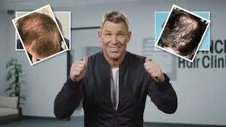 Hair thinning & hair loss solutions by Advanced Hair Studio. Shane Warne's story.