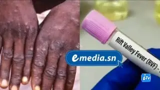 FIÈVRE DE LA VALLÉE DU RIFT ET MPOX AU SÉNÉGAL : L'INQUIÉTUDE DES POPULATIONS !