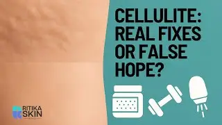 Can You Really Get Rid of Cellulite? Evidence-Based Solutions You Can Trust! Ritika Skin Science