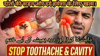 Cavity & Toothache Solution | Home Remedy That Works 💯