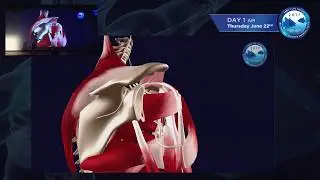 Welcome to Annecy Live Surgery 2017 - Advanced Shoulder Surgery Course