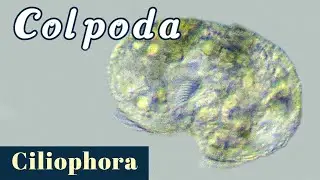 Colpoda (Ciliophora or Ciliate)